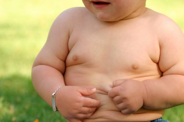 Anak obesitas - Istimewa