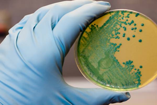 Pemeriksaan bakteri Listeria monocytogenes. - Istimewa