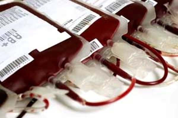 Hampir Setiap Hari, PMI Makassar Temukan Pendonor Darah Terinfeksi Virus HIV/AIDS