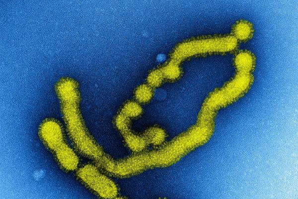 Partikel virus flu babi (influenza tipe A subtipe H1N1) - NIAID.