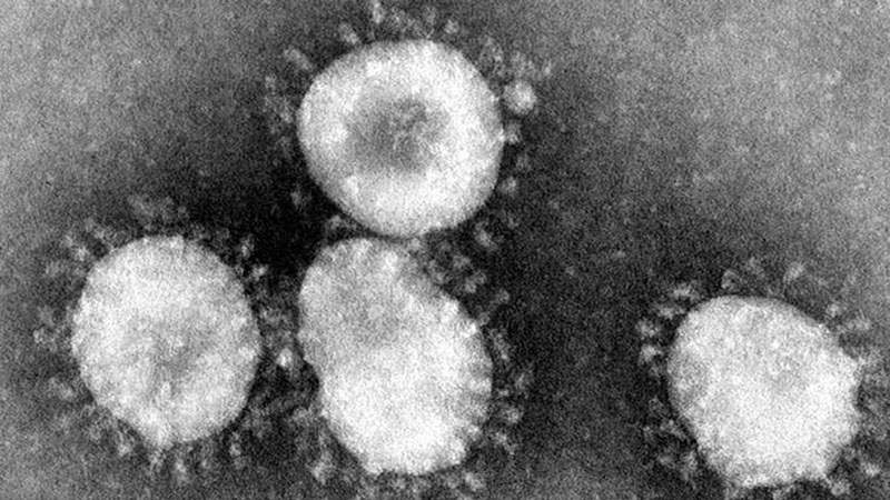 Penampakan Coronavirus di bawah lensa mikroskop. - DPA