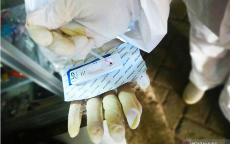 Ilusrasi-Petugas medis menujukkan alat rapid test saat rapid test massal di pasar tradisional di Makassar, Sulawesi Selatan. - ANTARA/Darwin Fatir.\n\n