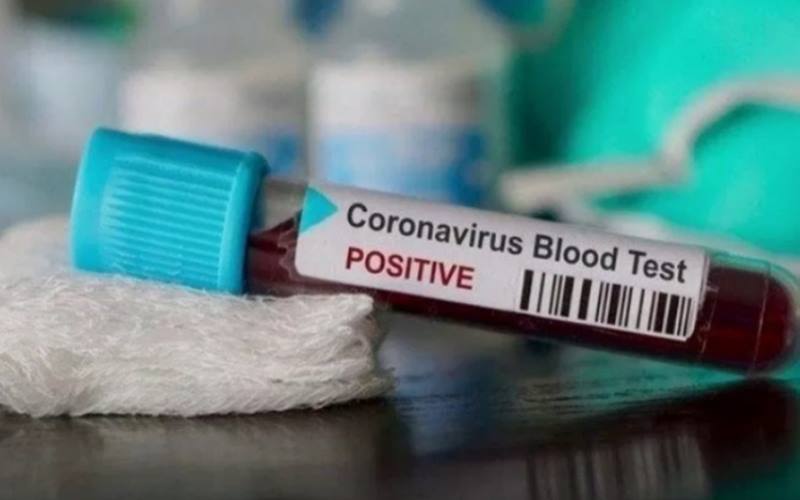 Ngawi Alami Penambahan Pasien Positif  Covid-19 Terbanyak Selama Pandemi