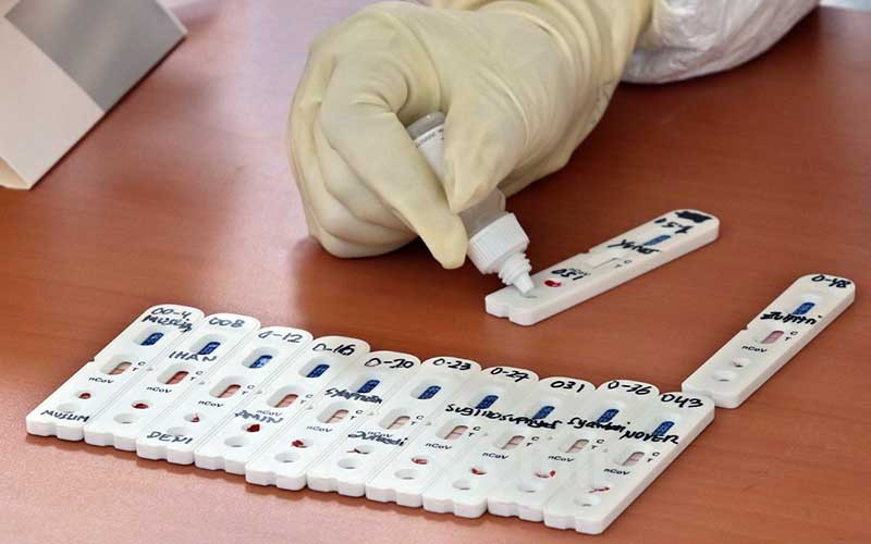 Petugas medis memperlihatkan sampel darah pengemudi angkutan umum saat tes cepat (Rapid Test) COVID-19 di Kantor Pusat Kementerian Perhubungan, Jakarta, Senin (20/4/2020). Bisnis - Eusebio Chrysnamurti