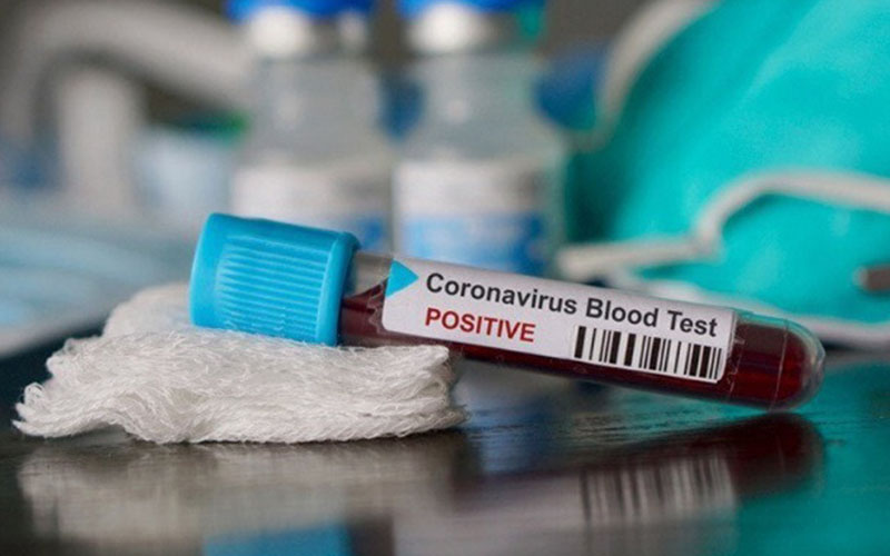 Ilustrasi sampel darah yang terindikasi positif virus corona/Antara - Shutterstock