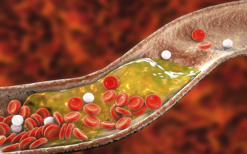 Cholesterol Facts: Types to Ways to Increase Good Cholesterol Levels