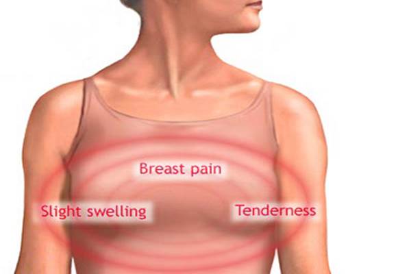 Gejala kanker payudara - breastcancersymptoms.com