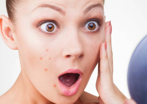 Wajah berjerawat - acne.com