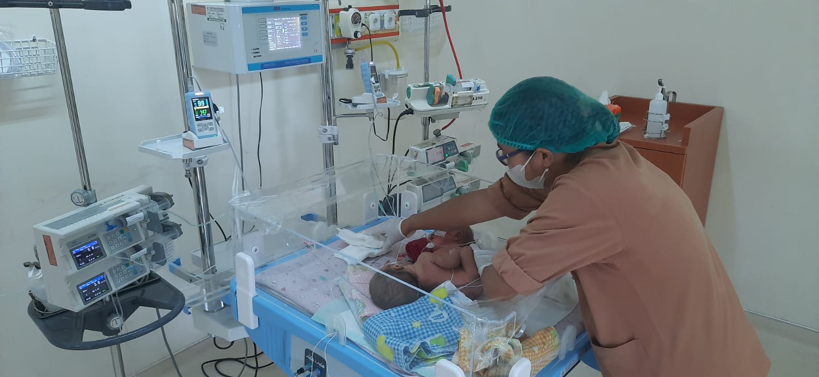 Update Kondisi Bayi Kembar Siam di Sumut, Lahir dengan 3 Kaki dan Perut Menyatu