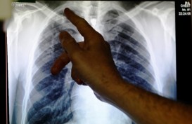 ARIFIN PANIGORO: Kasus TB Belum Sepenuhnya Jadi Perhatian Masyarakat