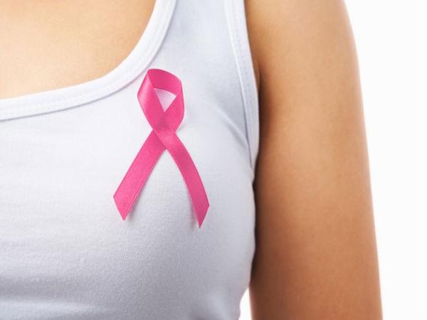 Ilustrasi kanker payudara - Istimewa