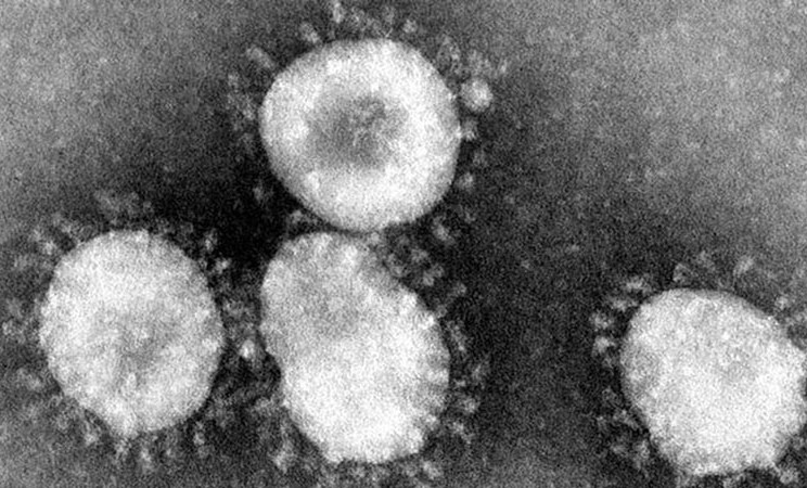 Penampakan Coronavirus di bawah lensa mikroskop. - DPA