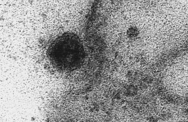 Detik-Detik Virus Corona Menyerang Sel Sehat