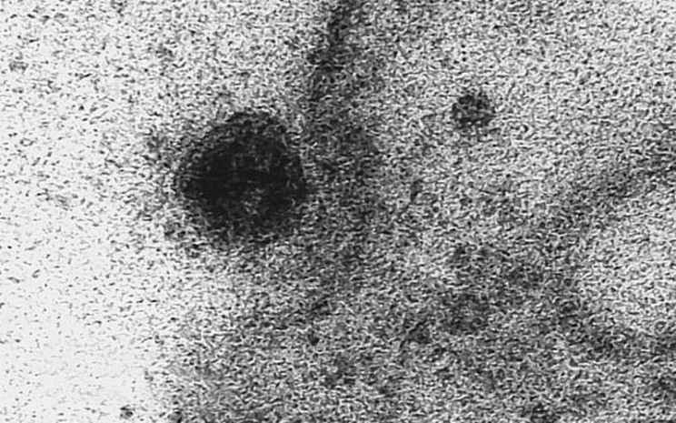 Virus SARS-CoV-2 menyerang sel sehat manusia (kotak hitam) sehingga menimbulkan penyakit Covid-19. - Dailymail