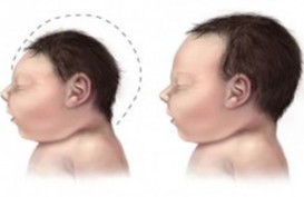Peneliti di Inggris Klaim Sampo Bayi Efektif 99,9 Persen Basmi Covid-19