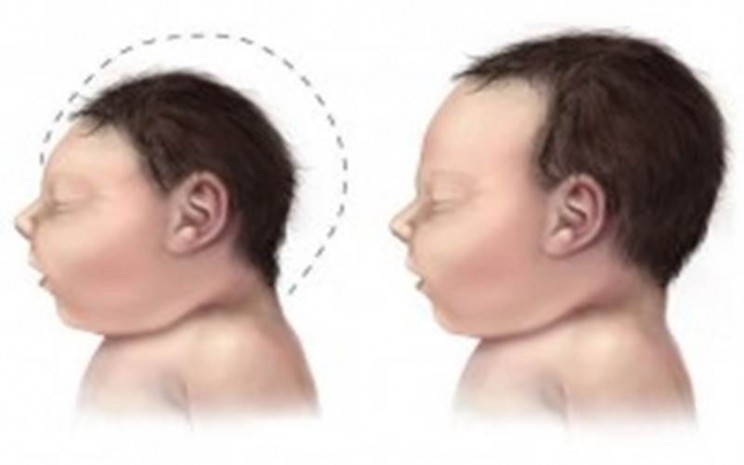 Peneliti di Inggris Klaim Sampo Bayi Efektif 99,9 Persen Basmi Covid-19