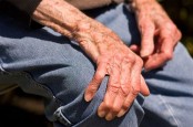 Peneliti Sebut Ganja Medis Kurangi Gejala Penyakit Parkinson