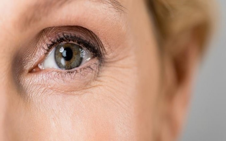 Bisa Sebabkan Kebutaan, Ini Penyebab Terjadinya Glaukoma, Termasuk Obat Tetes Mata
