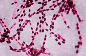 Virus Anthrax Picu Kematian 26 Sapi di Tulungagung