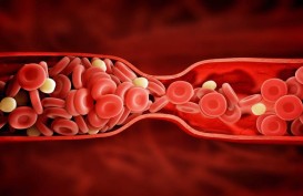Kenali Penggumpalan Darah Akibat Covid-19 dan Cara Menanganinya
