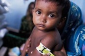 Miris, Pandemi Covid-19 Memperburuk Gizi Anak Indonesia