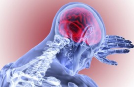 Pendarahan Otak: Jenis, Penyebab, dan Gejala