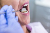 Obat Sakit Gigi yang dapat Dibeli di Apotek