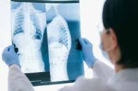 Studi Ungkap Peran Sel Paru-paru pada Sistem Kekebalan…