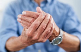 Tips Mencegah Risiko Radang Sendi Alias Arthritis