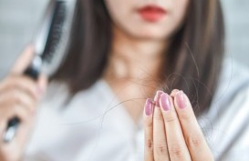 Cara Mengatasi Rambut Rontok dan Mencegah Kebotakan