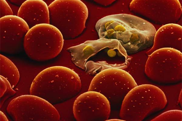 Parasit penyebab malaria - scitechdaily.com