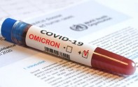 Mengenal Layanan PCR O+ yang Mampu Deteksi Varian Probable Omicron
