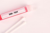 Ketahui Manfaat dan Estimasi Biaya Tes DNA