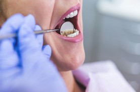Daftar Perawatan Gigi dan Mulut yang Ditanggung BPJS…