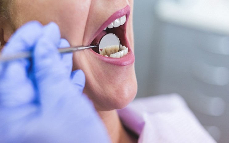Daftar Perawatan Gigi dan Mulut yang Ditanggung BPJS Kesehatan