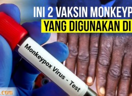AS Gunakan 2 Vaksin Atasi Cacar Monyet, Bagaimana Indonesia?