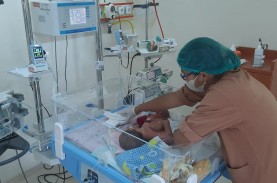 Update Kondisi Bayi Kembar Siam di Sumut, Lahir dengan…
