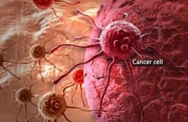 Nyeri di Badan yang Bisa Jadi Tanda-tanda Kanker yang Harus Diwaspadai