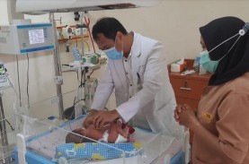Dilema Penanganan Bayi Kembar Siam di Sumut, Punya…