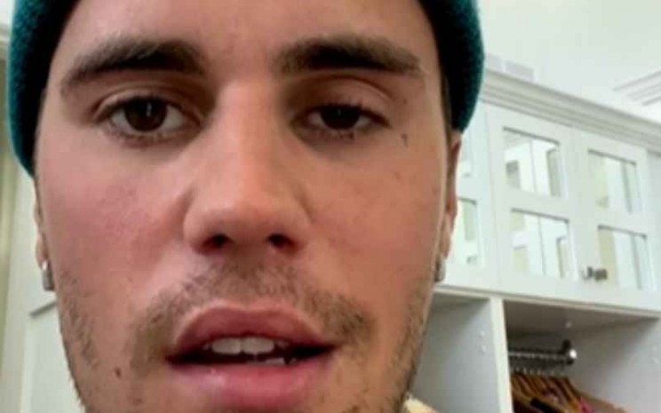 Justin Bieber Alami Kelumpuhan di Setengah Wajahnya, Konser Ditunda