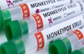 Monkeypox Global: 26.864 Kasus di 87 Negara, AS Terbanyak