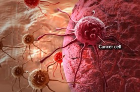 Berikut 14 Jenis Pengobatan Kanker