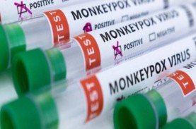 Update Monkeypox Global: 28.229 Kasus di 87 Negara,…