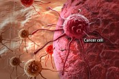 Studi: Pria Lebih Rentan Terkena Kanker daripada Perempuan