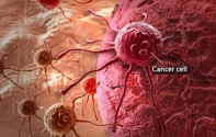 Studi: Pria Lebih Rentan Terkena Kanker daripada Perempuan