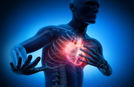 Ini Gejala, Penyebab dan Cara Mengatasi Serangan Jantung